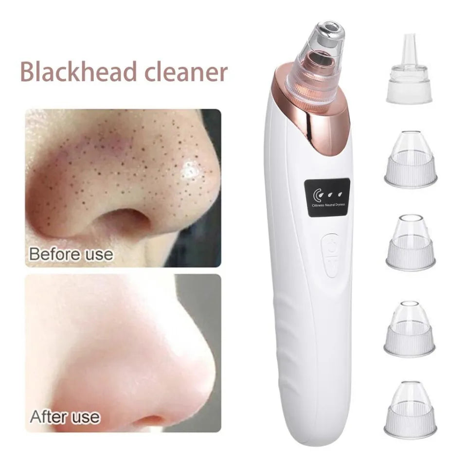 5 in 1 Electric Blackhead Remover | Guaranteed Results