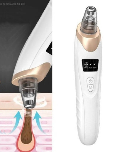 5 in 1 Electric Blackhead Remover | Guaranteed Results