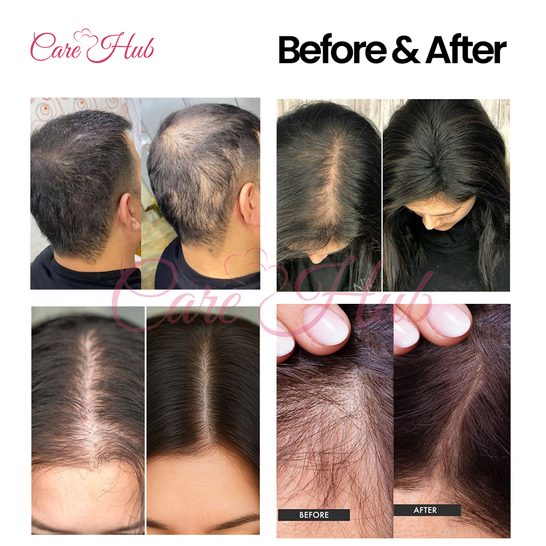 Kalwanji Hair Growth Shampoo – Hair Fall Solution - Fast Hair Growth